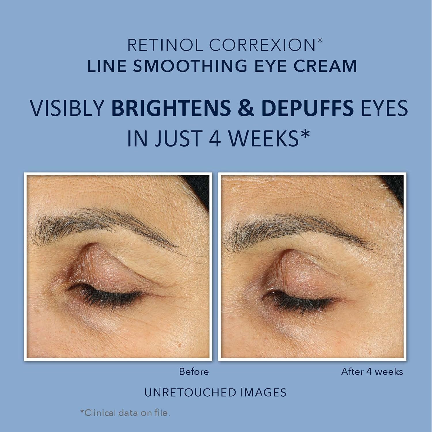 Retinol Correxion Value Set Duo, Deep Wrinkle Anti-Aging Night Face Cream + D…