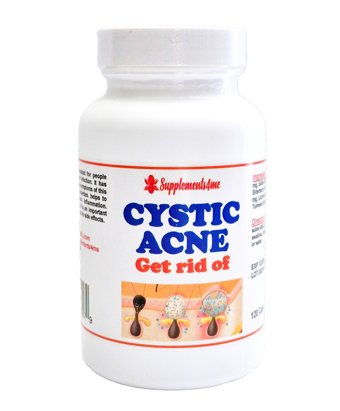 POWERFUL HERBS FOR CYST ACNE MEN WOMEN- 100% NATURAL – 120 CAPS – MADE IN USA