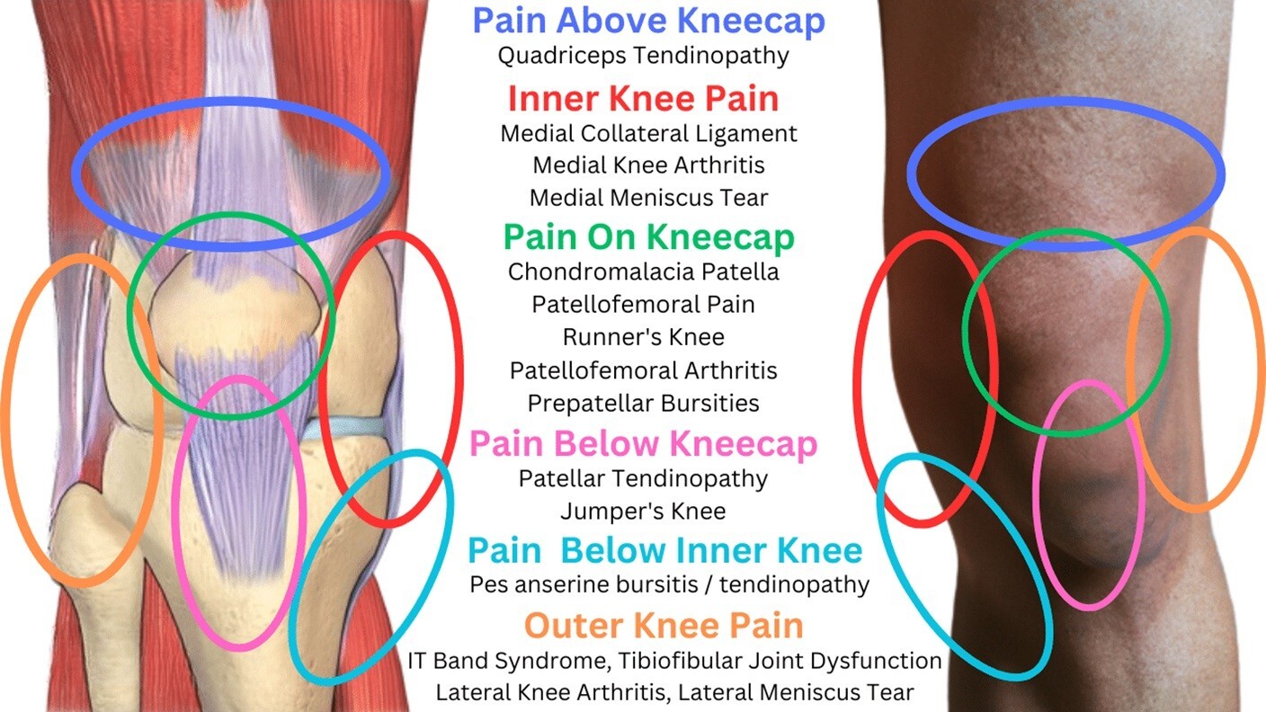 NATURAL HEALTHY SUPPORT FOR KNEE PAIN WOMEN & MEN – 100% HERBAL – MADE IN USA
