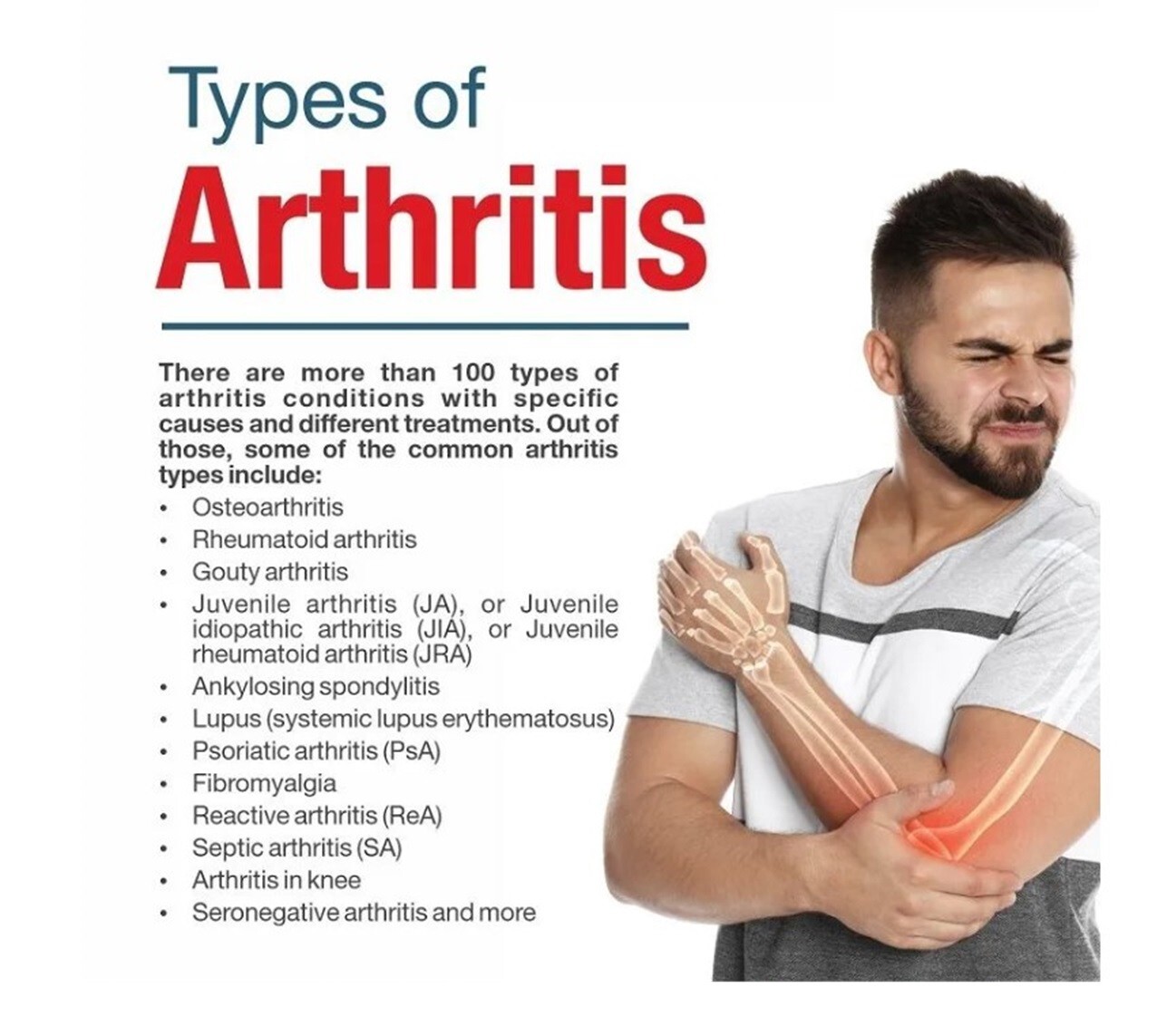 911 PAIN HERBS TO BE HAPPY FOR ARTHRITIS PAIN EVERYBODY – 120 CAPS MADE IN USA