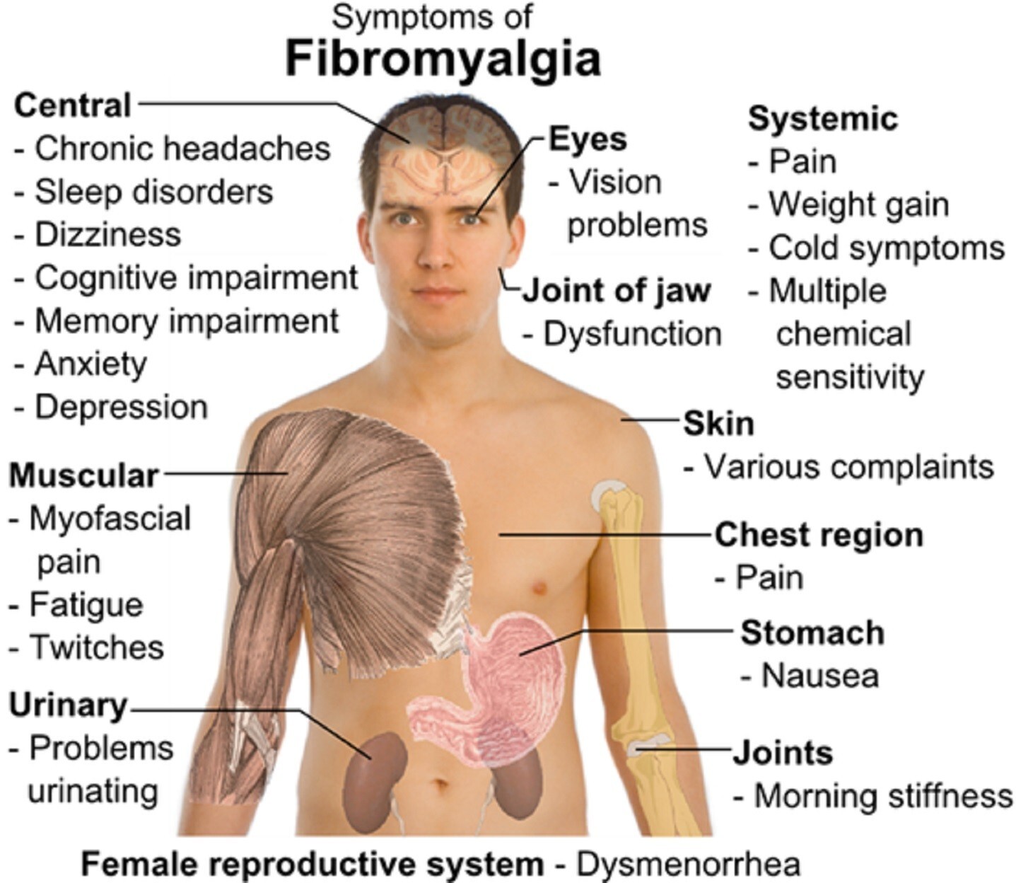 POWERFUL FIBROMYALGIA PAIN CREAM FOR WOMEN MEN – 100% HERBAL – MADE IN USA