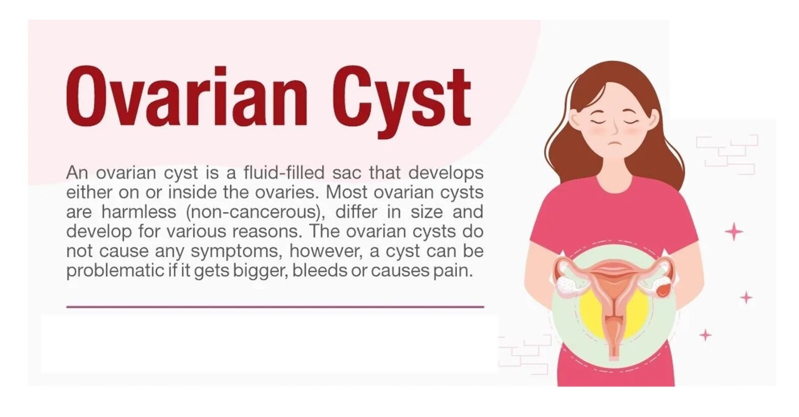 NATURAL STRONG HERBS FOR HEALTHY WOMEN OVARIAN CYST – 100% NATURAL – MADE IN USA