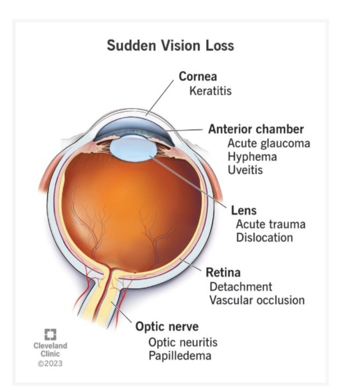 STOP VISION LOSS FOR EVERYBODY – 100% NATURAL HERBAL – Made in USA