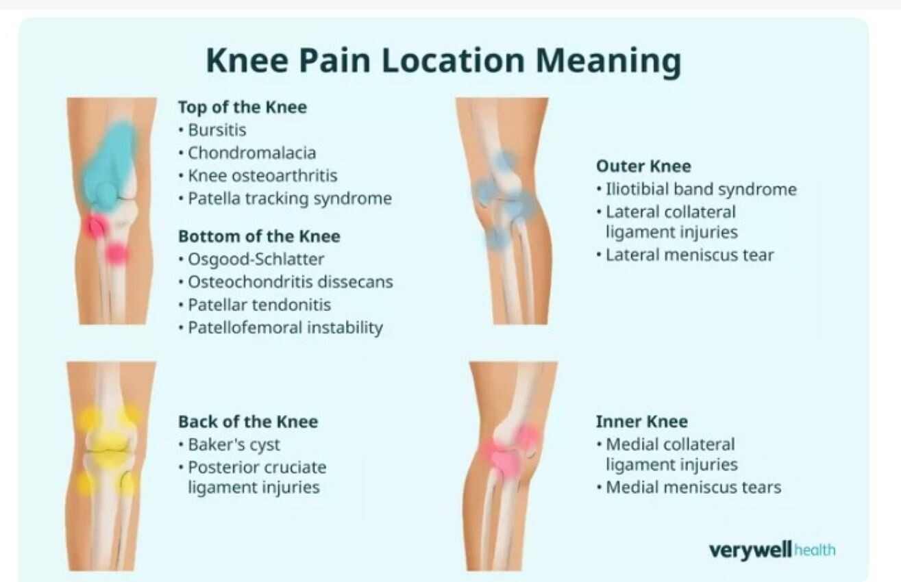 NATURAL HEALTHY SUPPORT FOR KNEE PAIN WOMEN & MEN – 100% HERBAL – MADE IN USA