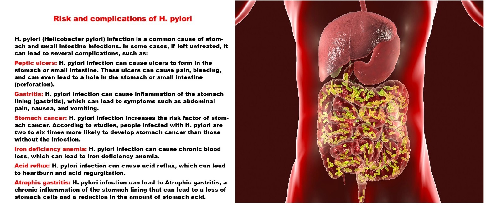 NATURAL HERBS FOR STOMACH BACTERIA – H. PYLORI IN GUMMIES – MADE IN USA