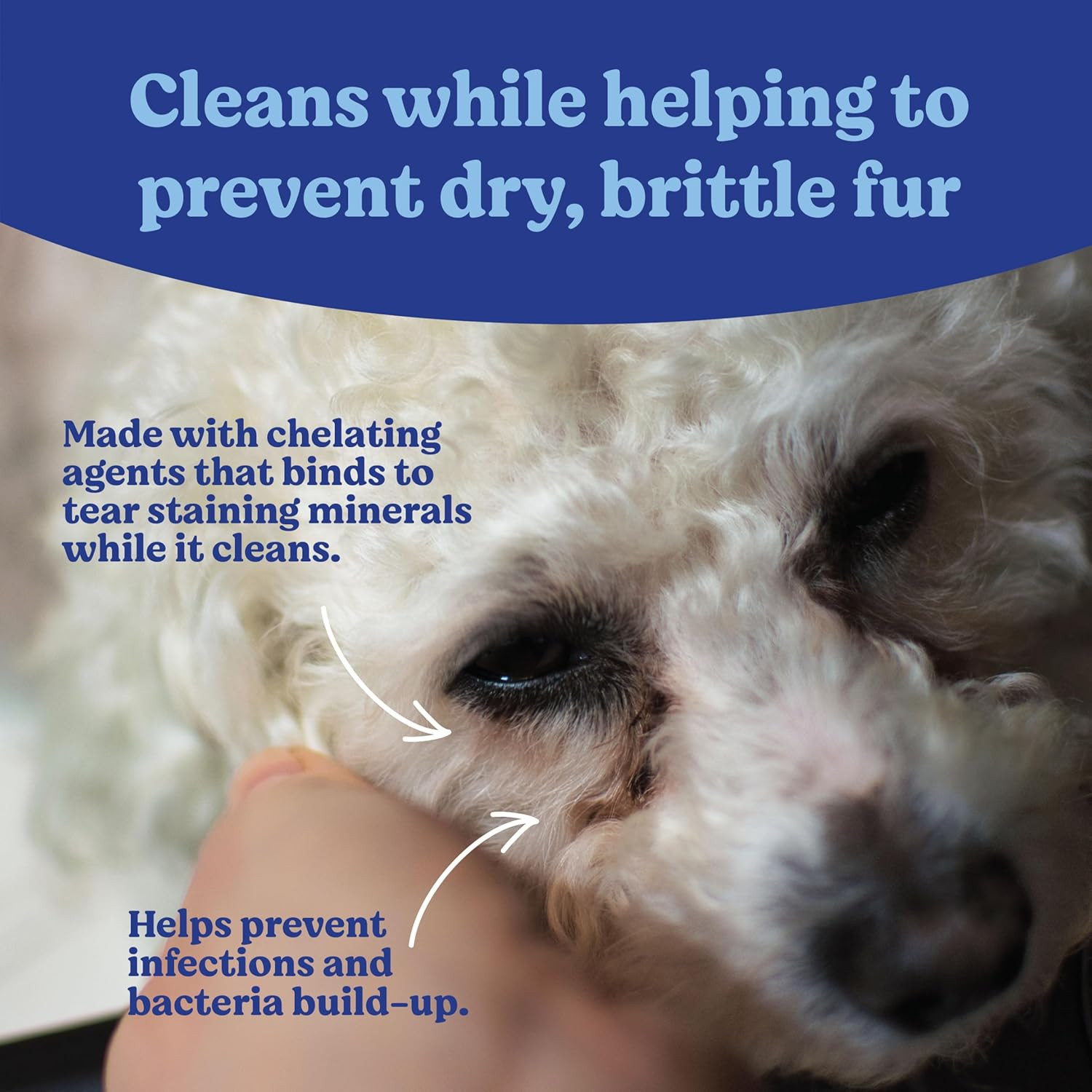 Angel’S Eyes Gentle Tear Stain Wipes for Dogs and Cats – 100 Ct – Presoaked Text