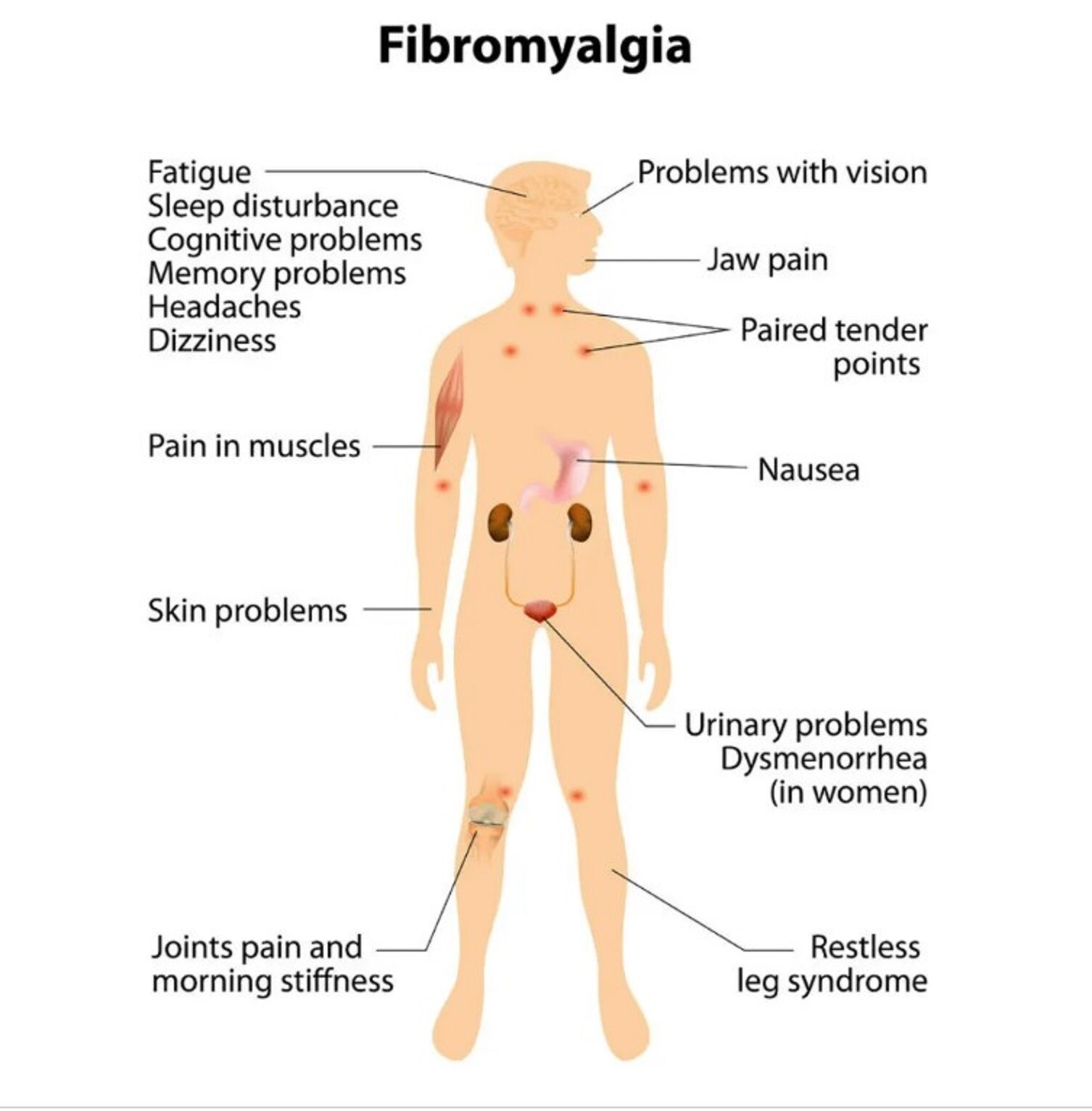 100% POWERFUL HERBS FOR FIBROMYALGIA PAIN WOMEN & MEN – 120 CAPS – MADE USA