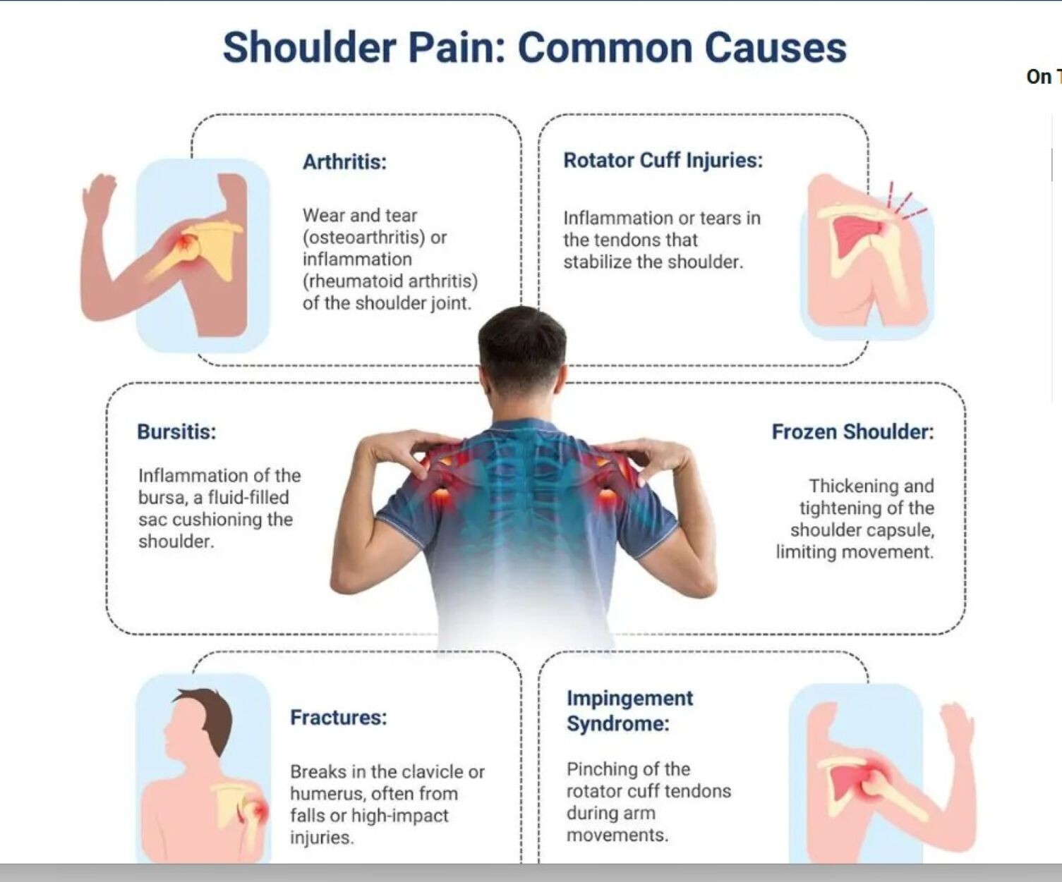 STRONG ORGANICS HERBS FOR SHOULDER PAIN MEN & WOMEN – 120 CAPS CAPSMADE IN USA