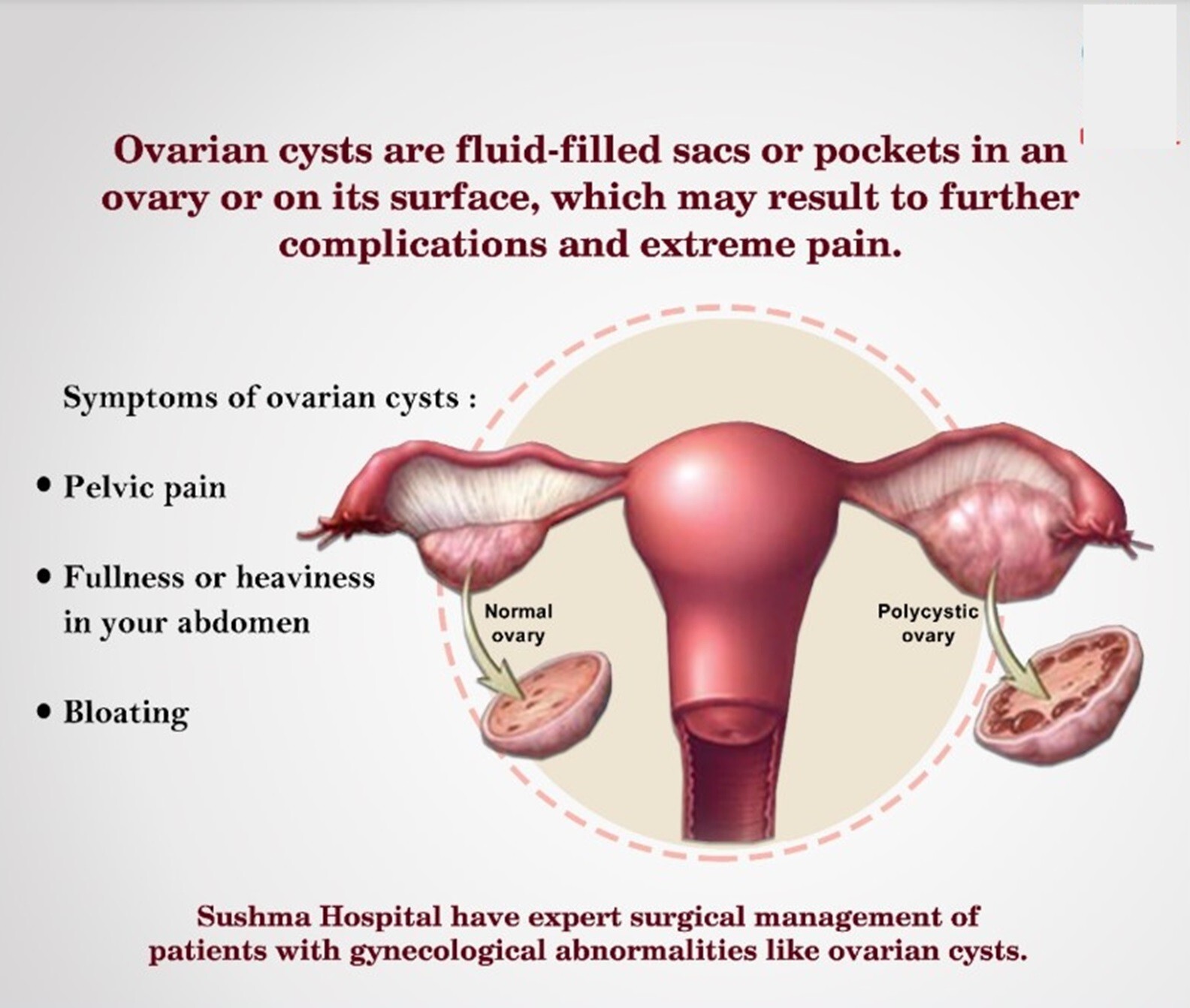 NATURAL STRONG HERBS FOR HEALTHY WOMEN OVARIAN CYST – 100% NATURAL – MADE IN USA