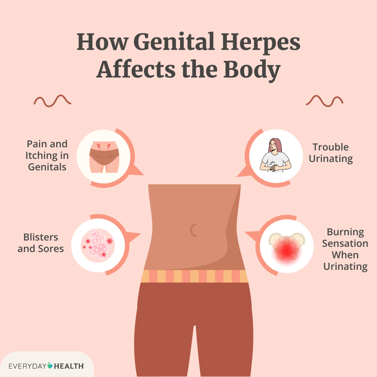 ORGANIC HERBS FOR VIRUS (HSV-2) WOMEN & MEN – 120 CAPS NATURAL – MADE IN USA