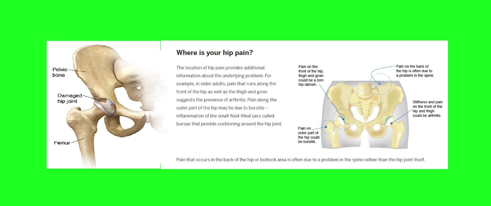 POWERFUL STRONG HIP JOINT PAIN CREAM FOR WOMEN MEN – 100% HERBAL – MADE IN USA