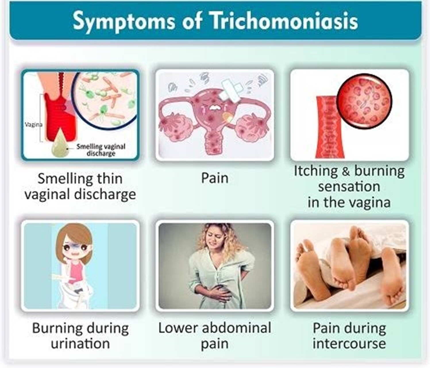 100% NATURAL HERBALS THERAPY FOR TRICHOMONIASIS STI ID 120 CAPS – MADE IN USA