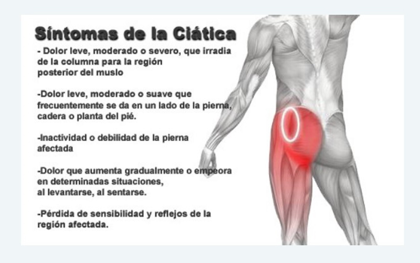 POWERFUL HERBS FOR SCIATICA PAIN IN MEN & WOMEN – 120 CAPS – MADE IN USA
