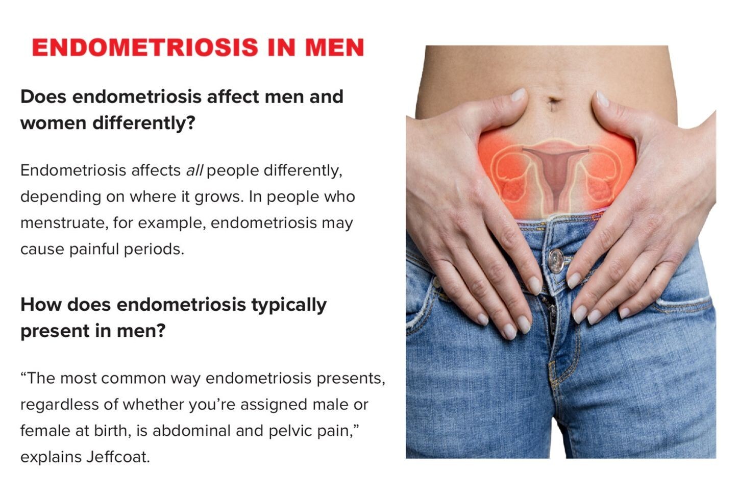 100% STRONG HERBS FOR ENDOMETRIOSIS WOMEN & MEN – 120 CAPS – MADE USA