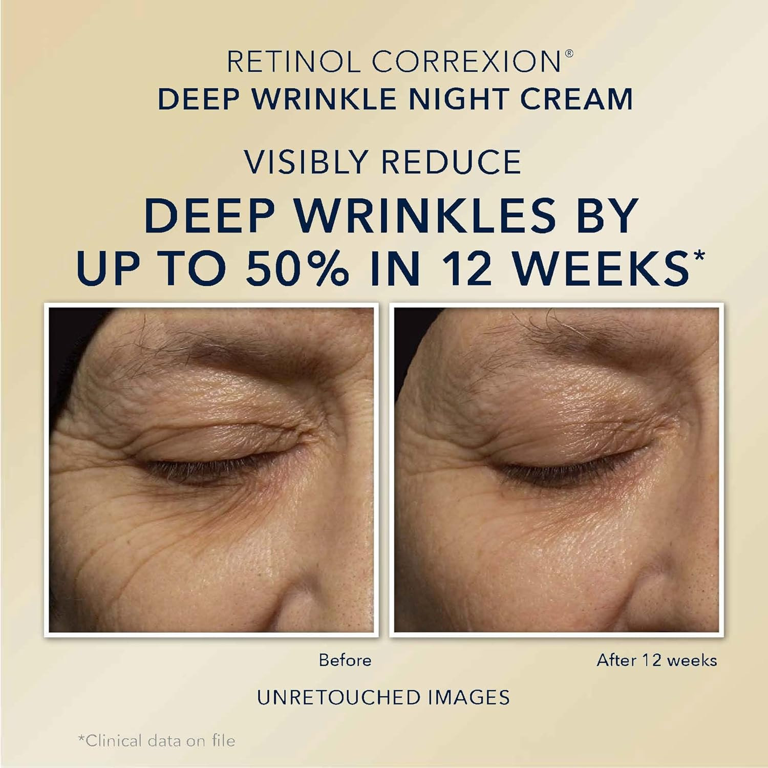 Retinol Correxion Value Set Duo, Deep Wrinkle Anti-Aging Night Face Cream + D…