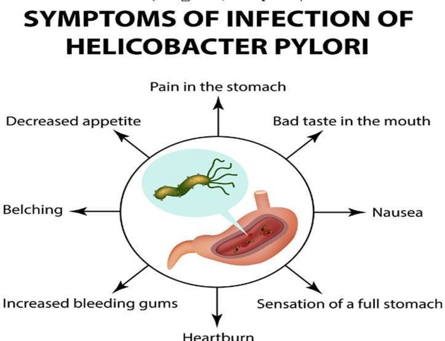 NATURAL HERBS FOR STOMACH BACTERIA – H. PYLORI IN GUMMIES – MADE IN USA