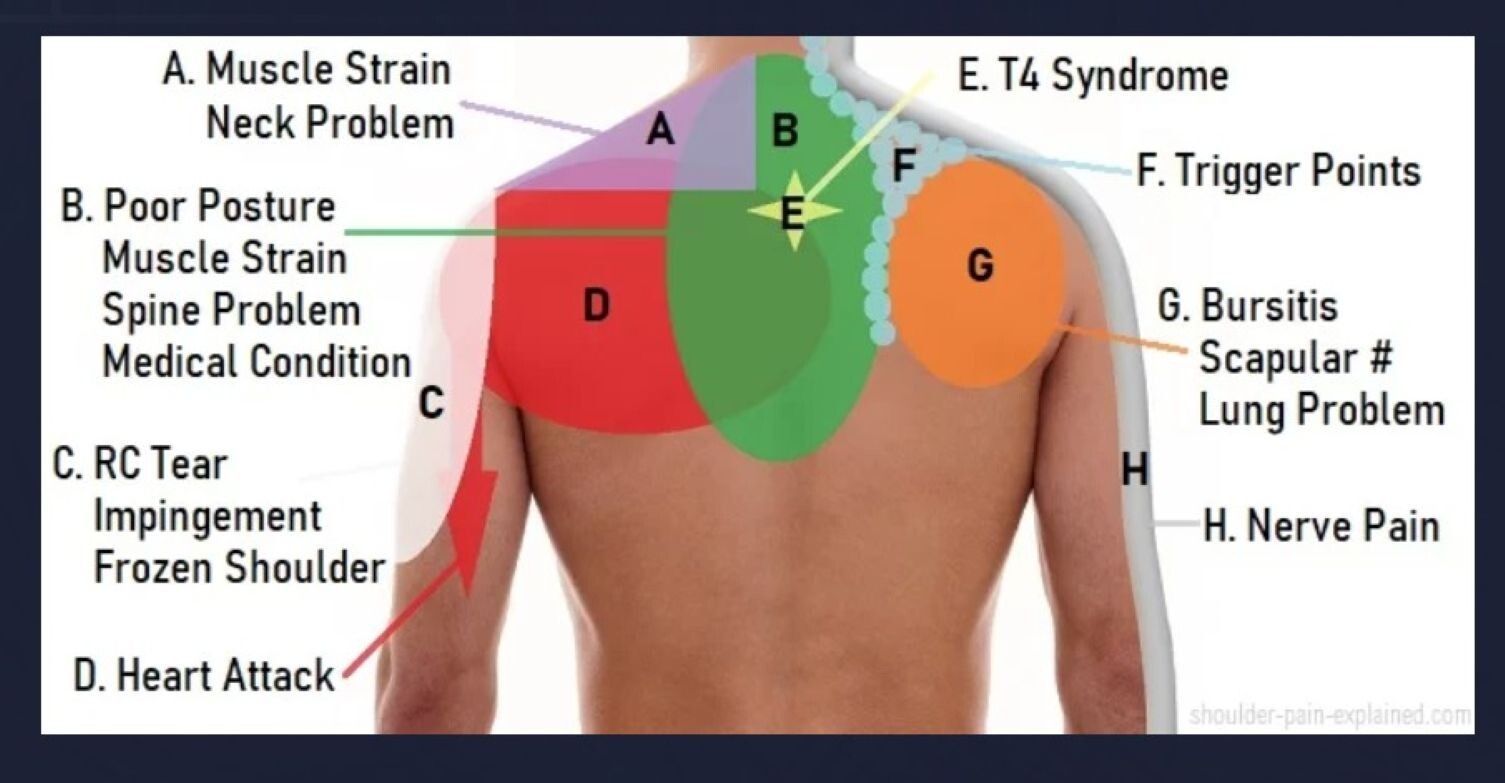 STRONG ORGANICS HERBS FOR SHOULDER PAIN MEN & WOMEN – 120 CAPS CAPSMADE IN USA