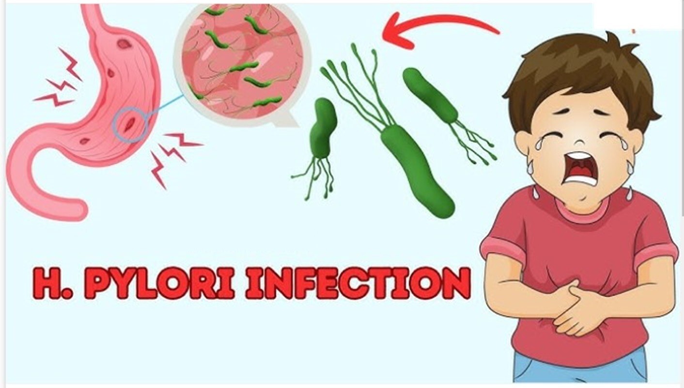 NATURAL HERBS FOR STOMACH BACTERIA – H. PYLORI IN GUMMIES – MADE IN USA